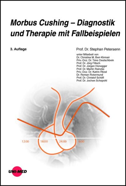 Produktbild: Morbus Cushing - Diagnostik und Therapie mit Fallbeispielen