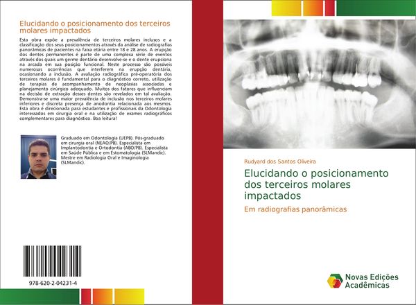 Produktbild: Elucidando o posicionamento dos terceiros molares impactados