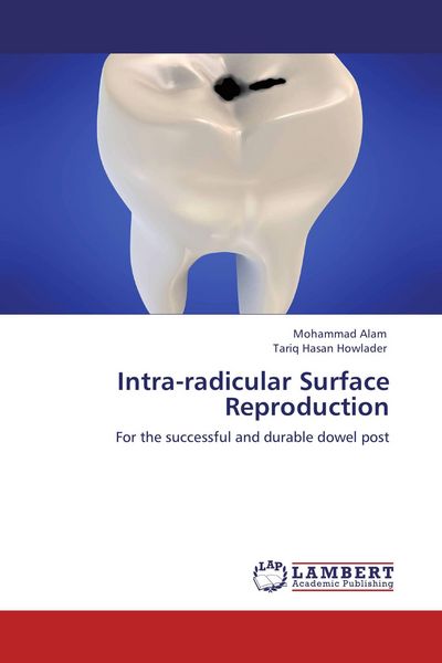 Produktbild: Intra-radicular Surface Reproduction