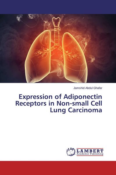 Produktbild: Expression of Adiponectin Receptors in Non-small Cell Lung Carcinoma