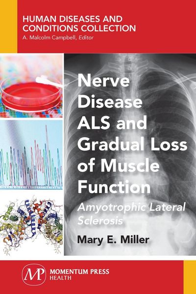 Produktbild: Nerve Disease ALS and Gradual Loss of Muscle Function