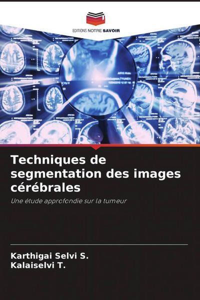 Produktbild: Techniques de segmentation des images c&eacute;r&eacute;brales