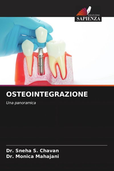Produktbild: Osteointegrazione