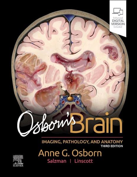 Produktbild: Osborn's Brain