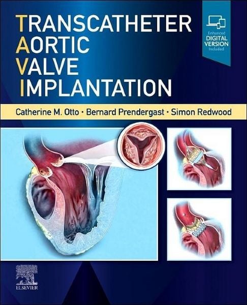 Produktbild: Transcatheter Aortic Valve Implantation