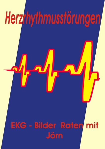 Produktbild: Herzrhythmusst&ouml;rungen