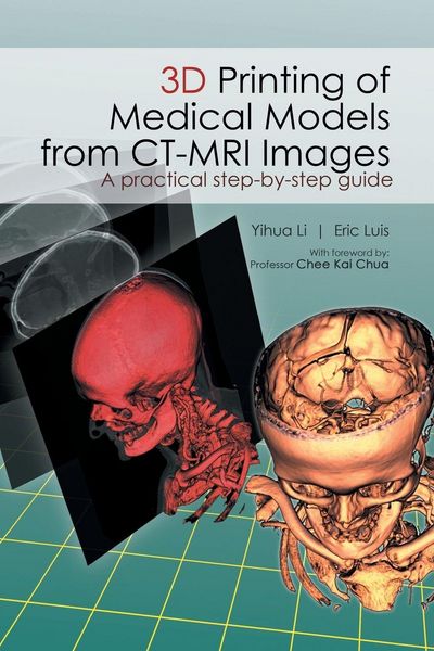 Produktbild: 3D Printing of Medical Models from CT-MRI Images