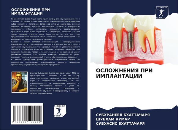 Produktbild: Oslozhneniya Pri Implantacii