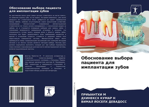 Produktbild: Obosnowanie wybora pacienta dlq implantacii zubow