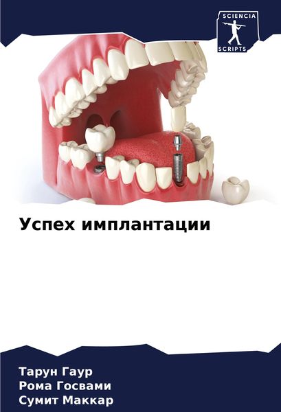 Produktbild: Uspeh implantacii