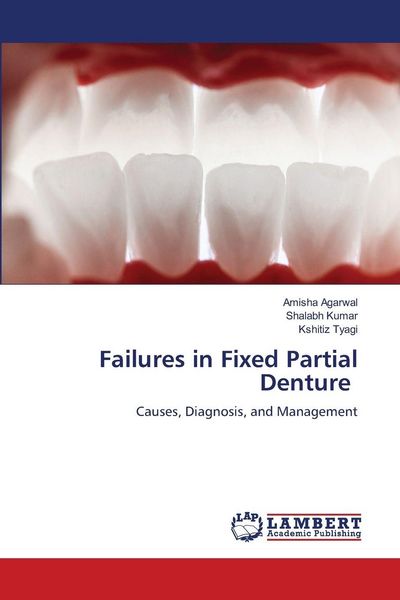 Produktbild: Failures in Fixed Partial Denture