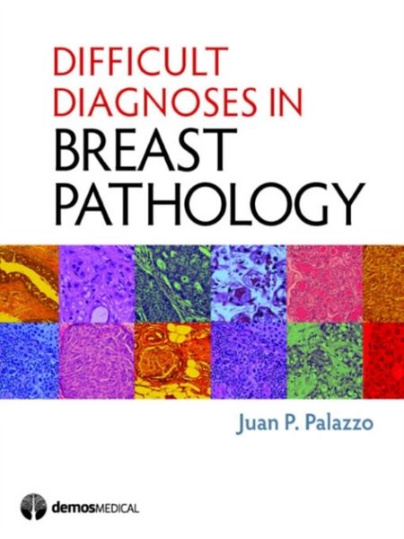 Produktbild: Palazzo, J: Difficult Diagnoses in Breast Pathology