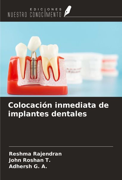 Produktbild: Colocaci&oacute;n inmediata de implantes dentales