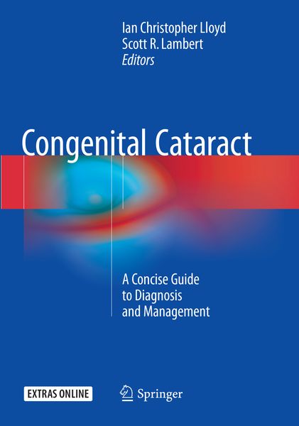 Produktbild: Congenital Cataract