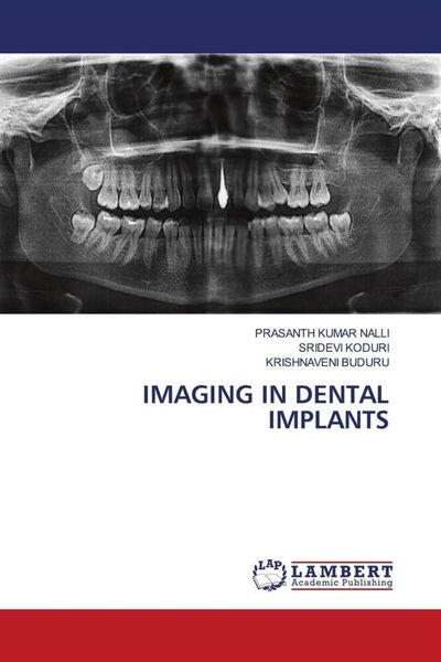 Produktbild: Imaging in Dental Implants
