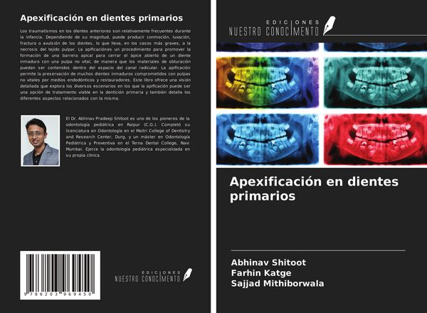 Produktbild: Apexificaci&oacute;n en dientes primarios