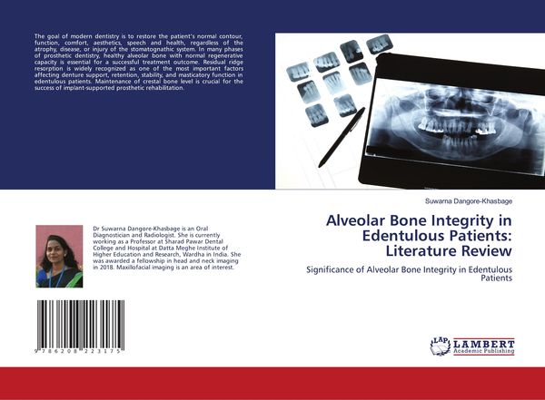 Produktbild: Alveolar Bone Integrity in Edentulous Patients: Literature Review