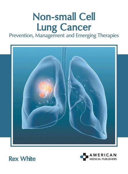 Produktbild: Non-Small Cell Lung Cancer: Prevention, Management and Emerging Therapies