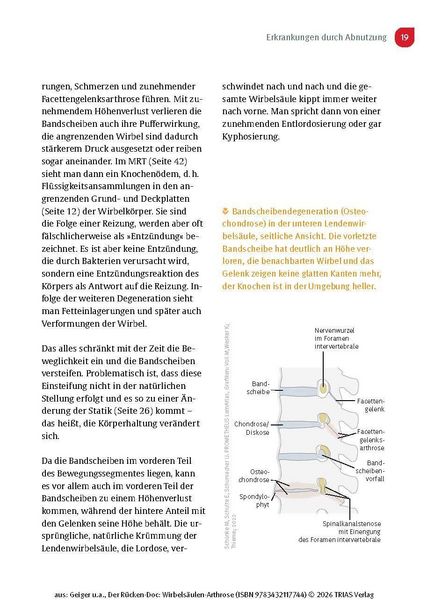 Produktbild: Der R&uuml;cken-Doc: Wirbels&auml;ulen-Arthrose