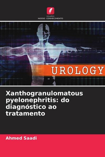 Produktbild: Xanthogranulomatous pyelonephritis: do diagn&oacute;stico ao tratamento