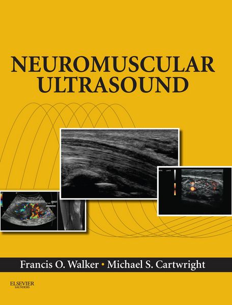 Produktbild: Neuromuscular Ultrasound E-Book