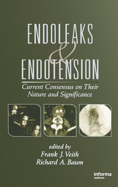 Produktbild: Endoleaks and Endotension