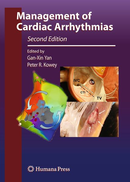 Produktbild: Management of Cardiac Arrhythmias