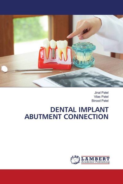 Produktbild: Dental Implant Abutment Connection
