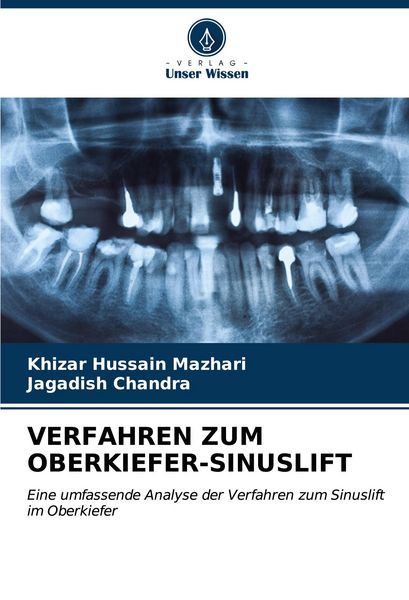 Produktbild: Verfahren Zum Oberkiefer-Sinuslift