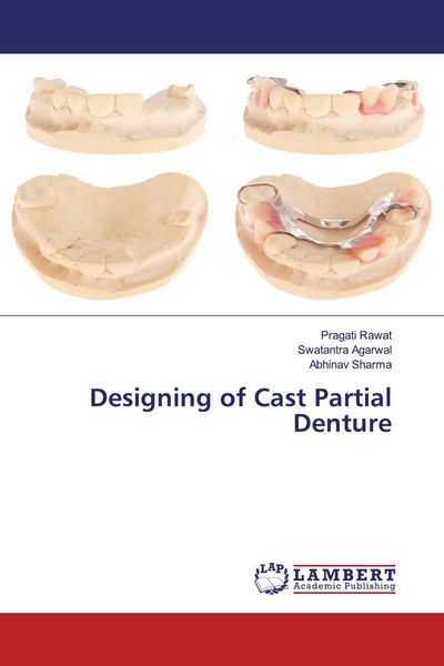 Produktbild: Designing of Cast Partial Denture