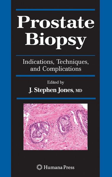 Produktbild: Prostate Biopsy