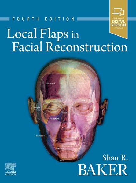 Produktbild: Local Flaps in Facial Reconstruction