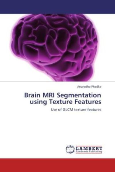 Phadke, A: Brain MRI Segmentation using Texture Features, Taschenbuch von Anuradha Phadke, LAP LAMBERT Academic Publishing, 9783659189517