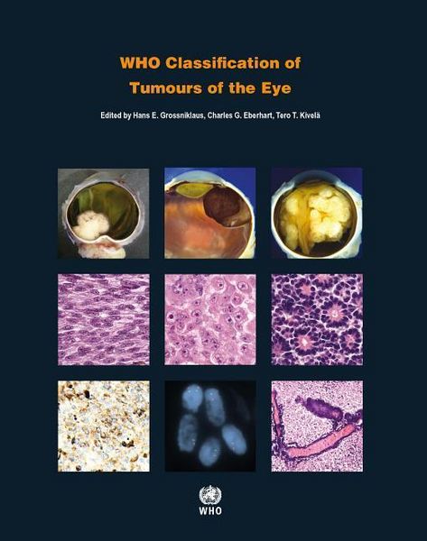 Produktbild: Who Classification of Tumours of the Eye