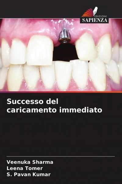 Produktbild: Successo del caricamento immediato