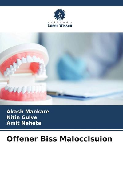 Offener Biss Malocclsuion, Taschenbuch von Akash Mankare , Nitin Gulve , Amit Nehete, Verlag Unser Wissen, 9786205002445