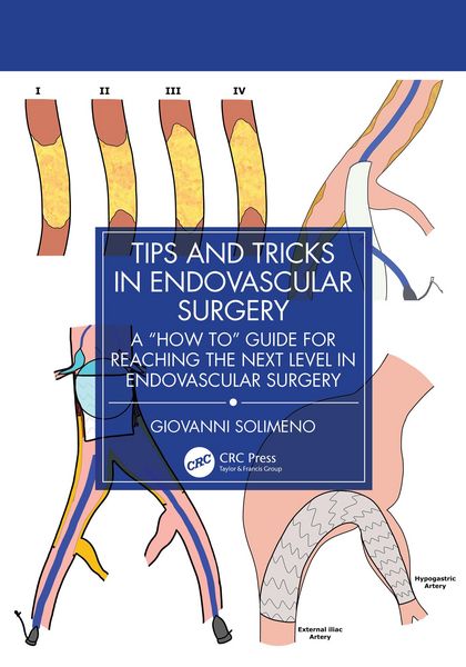 Produktbild: Tips and Tricks in Endovascular Surgery