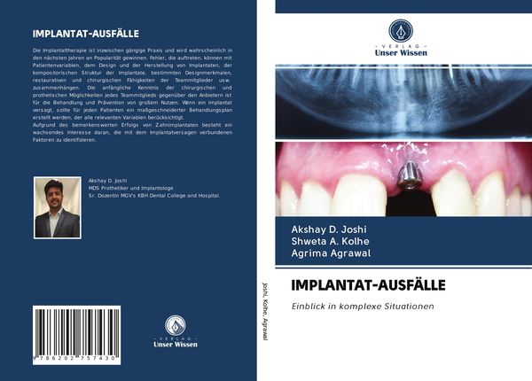 Produktbild: Implantat-Ausf&auml;lle