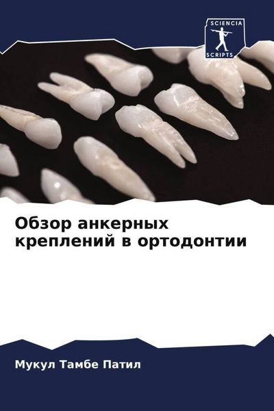 Produktbild: Obzor ankernyh kreplenij w ortodontii