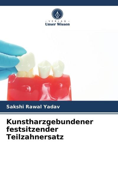 Produktbild: Kunstharzgebundener festsitzender Teilzahnersatz