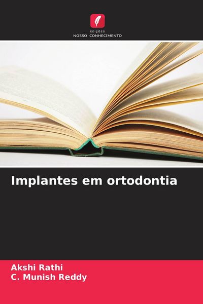 Produktbild: Implantes em ortodontia