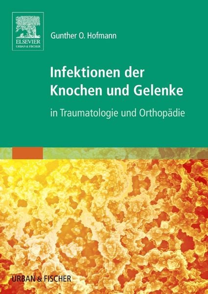 Produktbild: Infektionen der Knochen und Gelenke