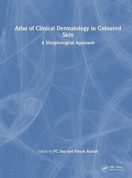 Produktbild: Atlas of Clinical Dermatology in Coloured Skin