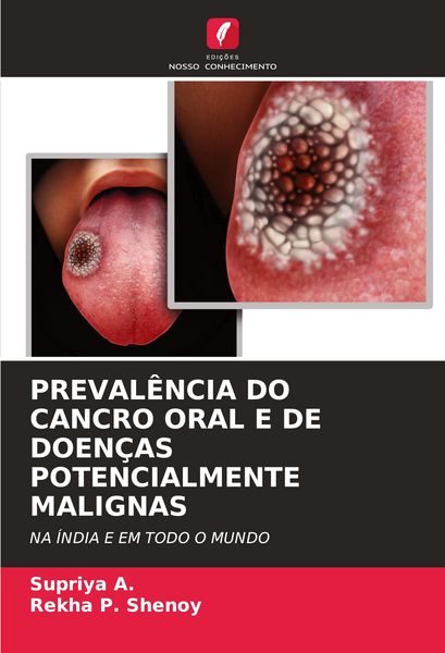 Produktbild: Preval&ecirc;ncia Do Cancro Oral E De Doen&ccedil;as Potencialmente Malignas