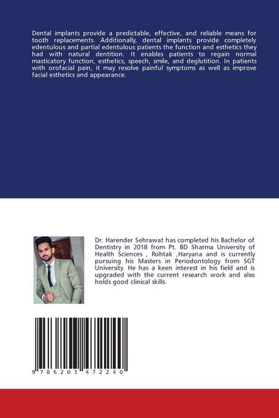 Produktbild: Dental Implants And Its Structures