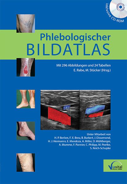 Produktbild: Phlebologischer Bildatlas