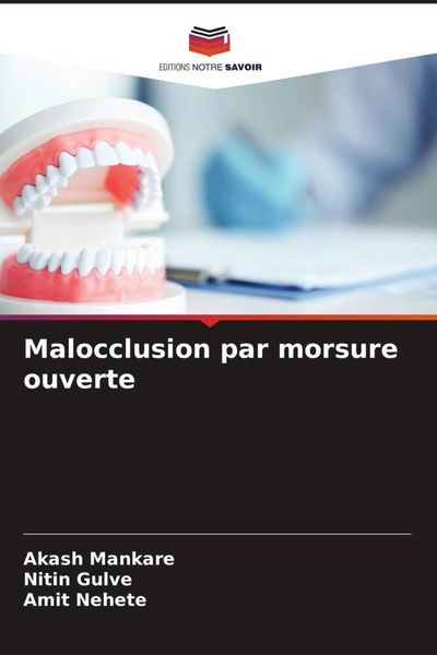 Produktbild: Malocclusion par morsure ouverte
