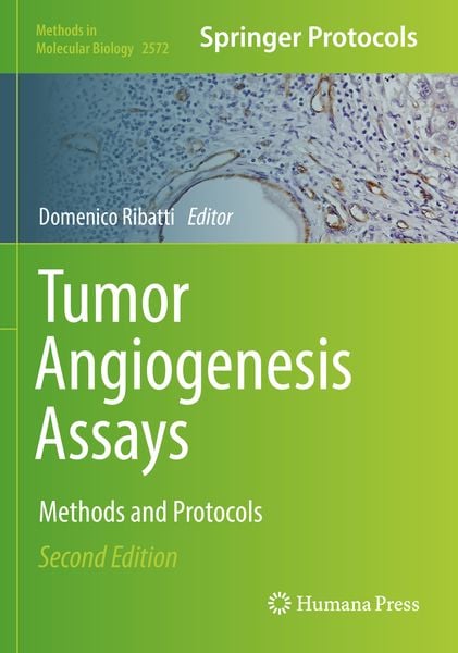 Produktbild: Tumor Angiogenesis Assays