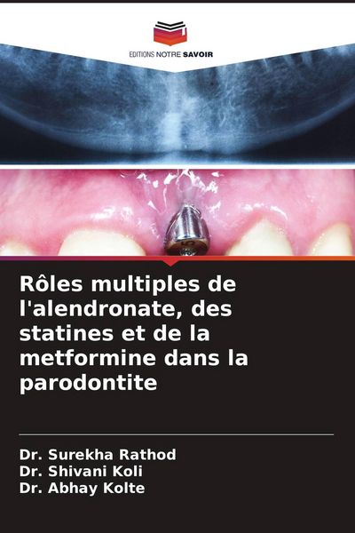 Produktbild: R&ocirc;les multiples de l'alendronate, des statines et de la metformine dans la parodontite