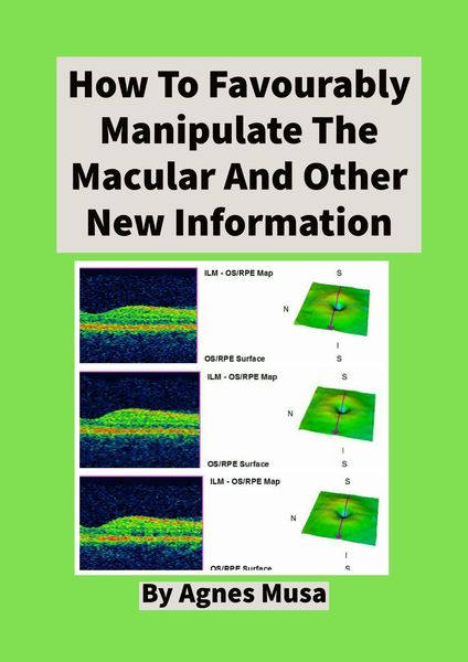 Produktbild: How To Favourably Manipulate The Macular And Other New Information